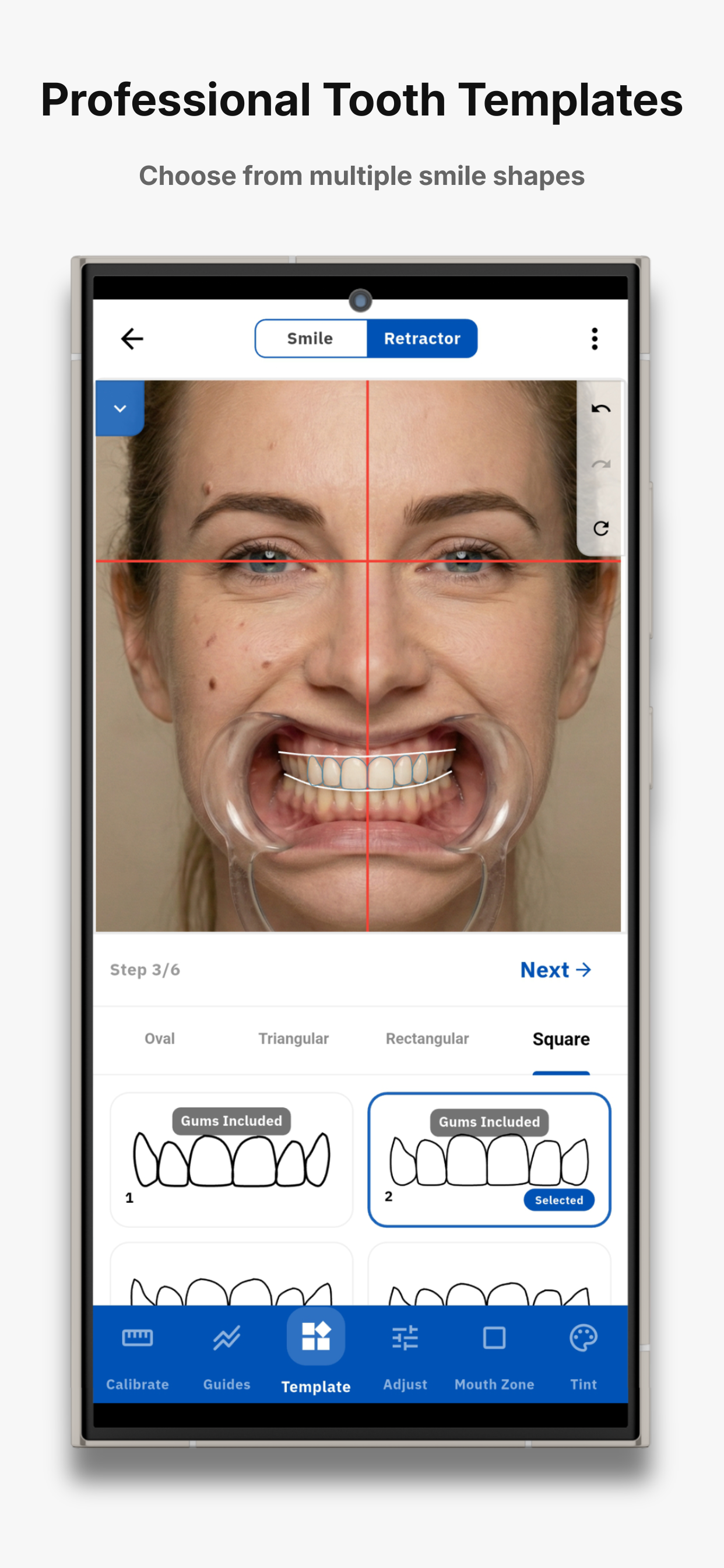 SmileX screenshot 4
