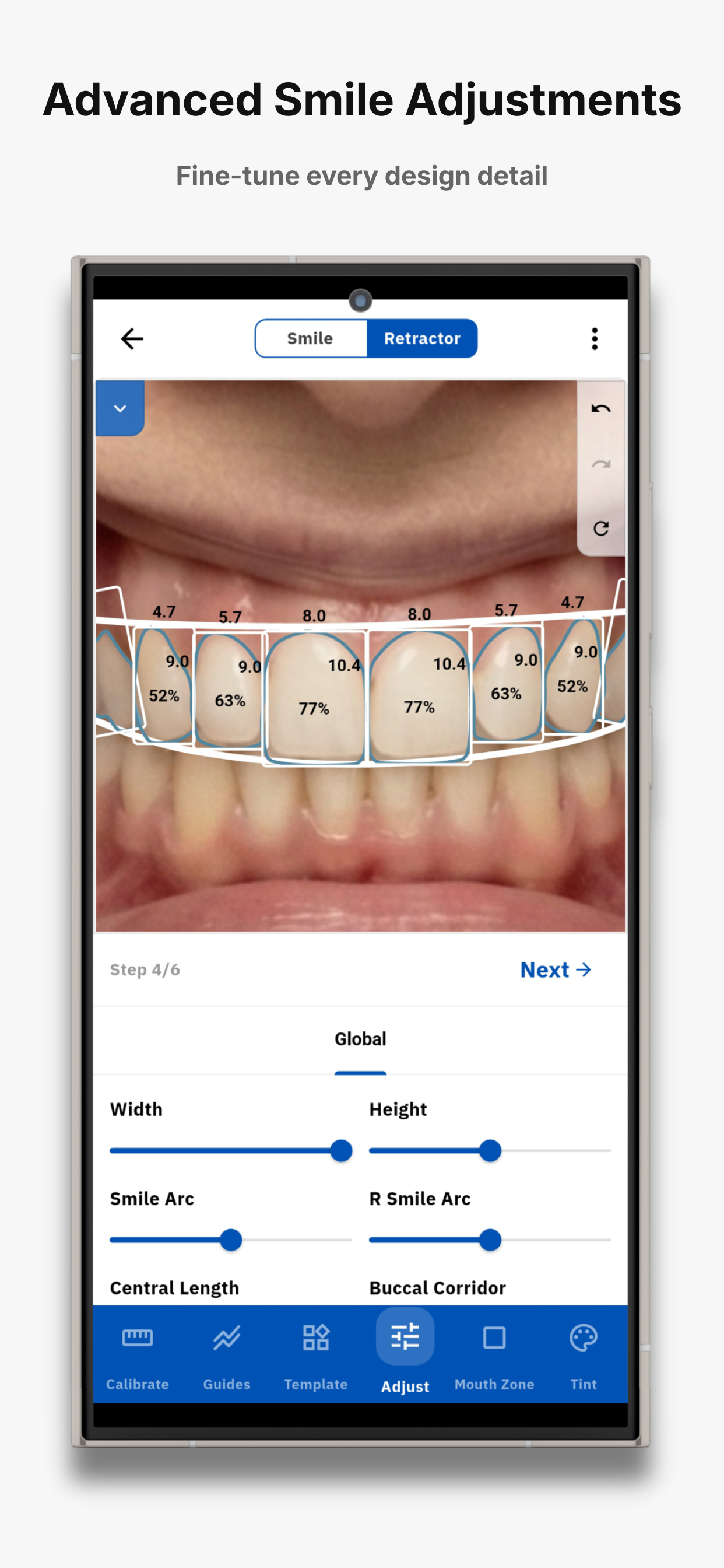 SmileX screenshot 5