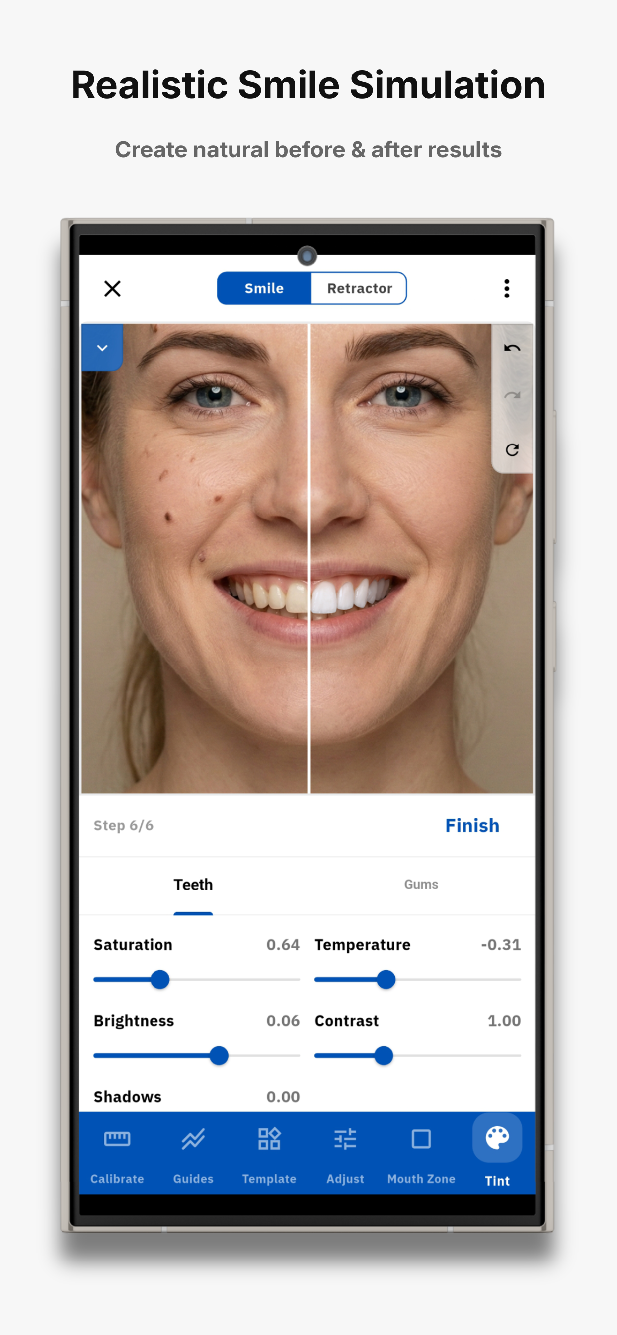 SmileX screenshot 6
